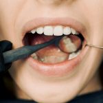 photo by Arvind Philomin of a woman's mouth checking teeth conditions